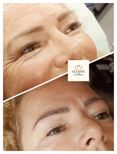 Visage de femme affichant des sourcils soignés et une peau avec des rides.