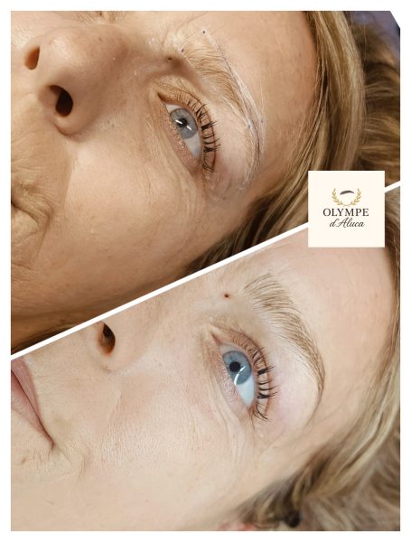 Visages de deux femmes, l'une avec des signes de vieillissement, l'autre avec une peau plus lisse.