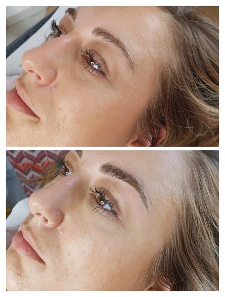 Portrait d'une femme montrant un avant et après une prestation de beauté des sourcils.