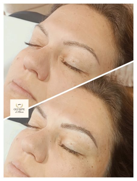 Avant et après d'un maquillage permanent des sourcils sur une femme avec les yeux fermés.