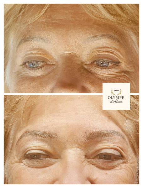 Regard rapproché des yeux d'une femme âgée, avec des rides autour des paupières.